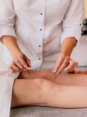 acupunctura_1